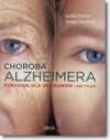 Choroba Alzheimera Poradnik dla opiekunów i nie tylko